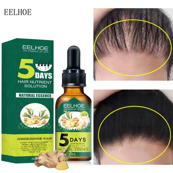 5 Days Ginger Hair Growth Essential Oils Fast Grow Hair Oil Anti Hair Loss Products Scalp.jpg Q90.jpg - Specifikacija: