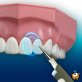 LN1089 aparat za ciscenje zuba i kamenca 06 w - DOBRODOŠLI NA IKSSHOP.COM