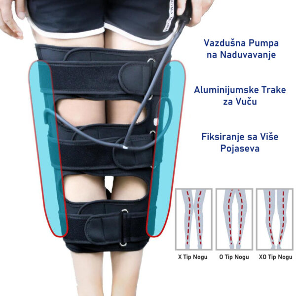 clipboard image c2aca62ee7d6f2d9 - Traka za ispravljanje nogu, za kolena. Rastezljivi pojas – Rastegljiva traka za noge i podesivi zavoj.