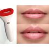 Lip enlarger – Aparat za punije usne – Lip enlarger – Aparat za punije usne - Image 2