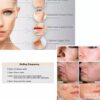 Derma roller Derma roler za kozu i kosu Roler za negu – Derma roller Derma roler za kozu i kosu Roler za negu - Image 3