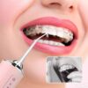 Irigator Oralni irigator Aparat za ciscenje zuba – Irigator Oralni irigator Aparat za ciscenje zuba - Image 4