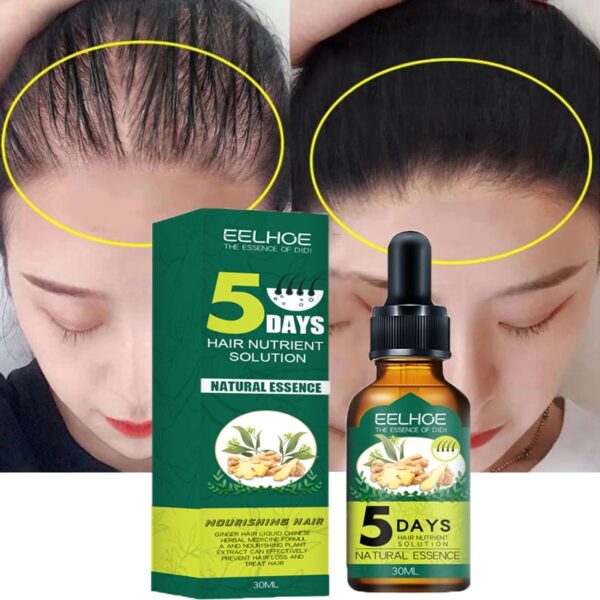 serum protiv opadanja kose 915058 - Razni faktori utiču na guibitak kose poput: genetike, alopecije, stresa, itd. Pobedite naizgled nepobediv problem jedinstvenim uljem đumbira!