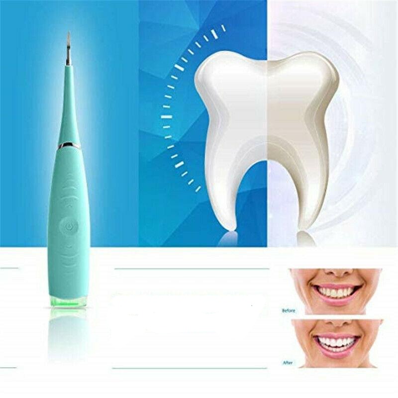 Ultrazvucni cistac zubnog kamenca - Image 2