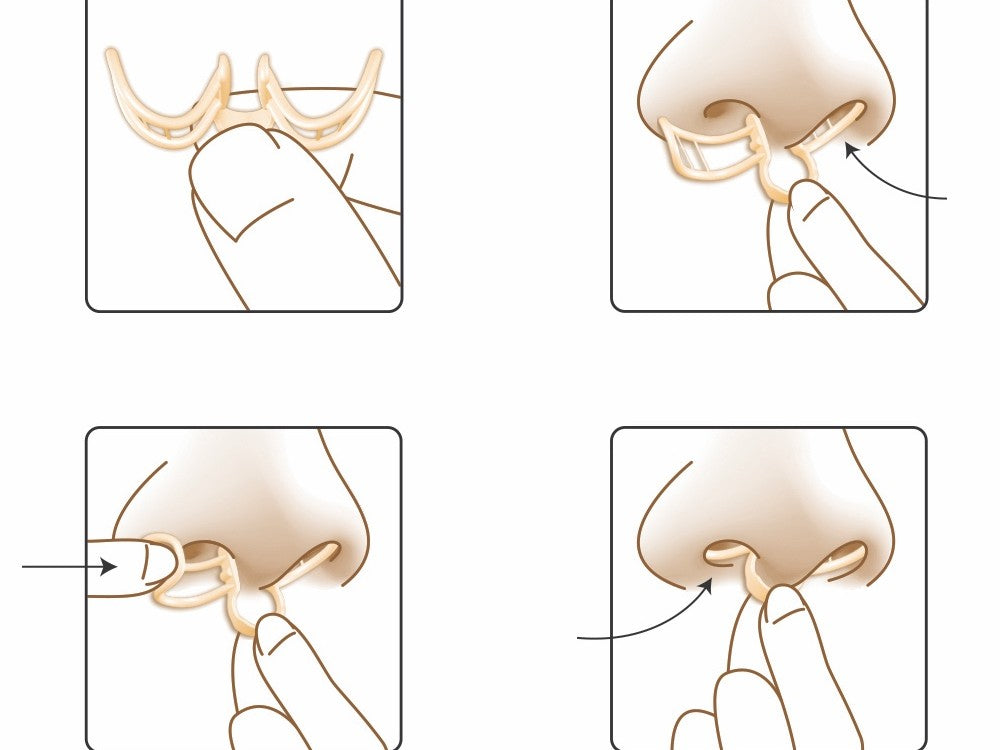 DILITATOR PROTIV HRKANJA – 3 KOM - Image 2